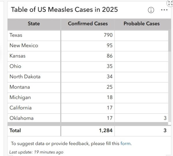 配资导航 美国麻疹疫情卷土重来 病例数量创近33年新高
